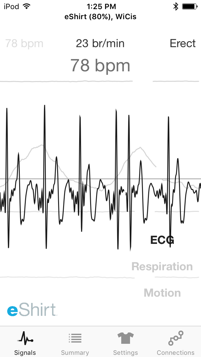 Live ECG Signals